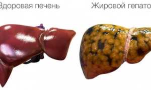 Диета при ожирении печени – что можно кушать, что нельзя