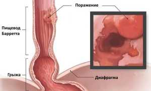 Строение пищевода человека – функции в организме человека