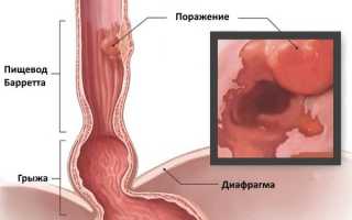 Строение пищевода человека – функции в организме человека