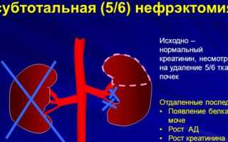 Удаление почки:показания, противопоказания и жизнь после операции