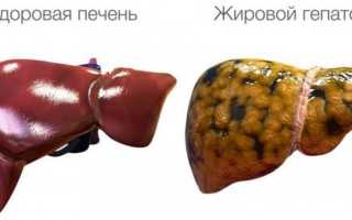 Диета при ожирении печени – что можно кушать, что нельзя