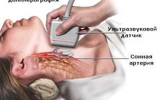 Синдром дефицита внимания и гиперактивности (СДВГ) у ребенка