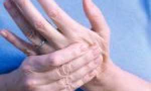 7 основных и множество дополнительных причин онемения рук и пальцев