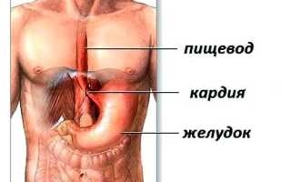 Ахалазия кардии: причины, симптомы, методы лечения