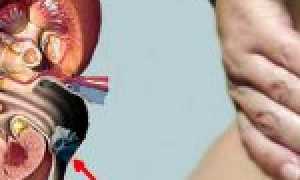 Причины и механизм развития гидронефроза у плода при беременности