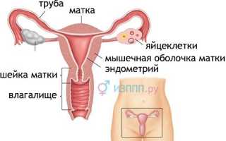Кольпит (вагинит): причины, признаки, диагностика, как лечить, особенности при беременности