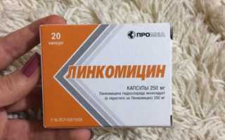 Таблетки «Линкомицин»: инструкция по применению, состав, дозировка и отзывы