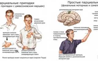 Судорожный синдром: развитие, признаки, диагностика, лечение