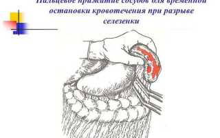 Разрыв селезенки у взрослых: симптомы, причины, лечение, последствия