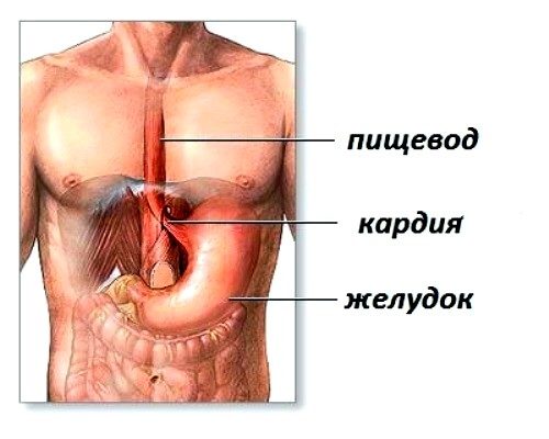 Ахалазия пищевода