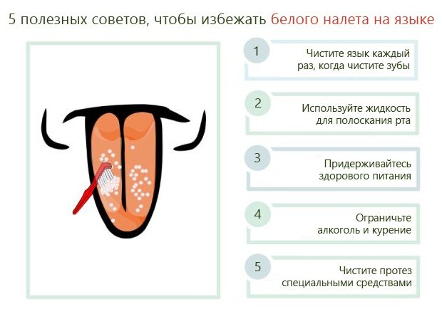 Белый, бело-желтый налет на языке у взрослых. Причины, лечение, как устранять