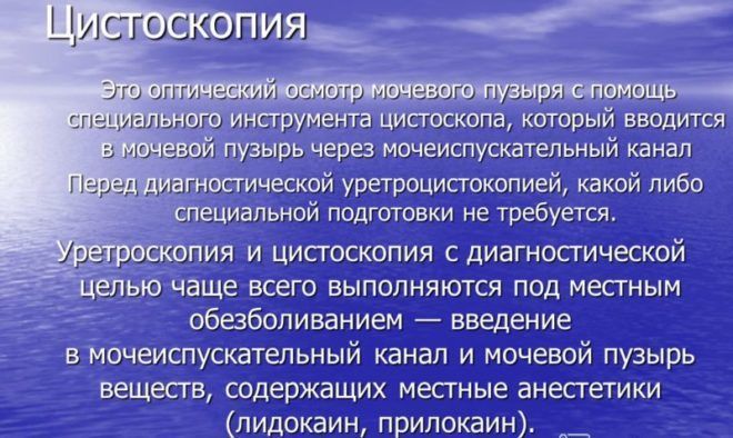 Цистоскопия это