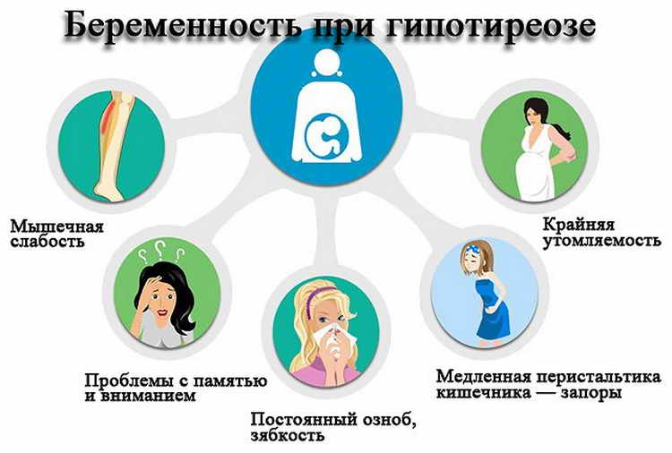 гипотиреоз при беременности последствия для ребенка