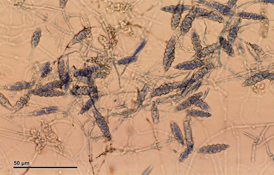 грибки microsporum