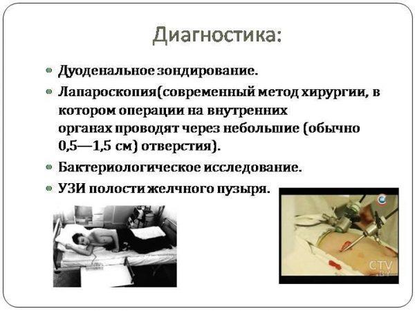 Методы диагностики холецистита