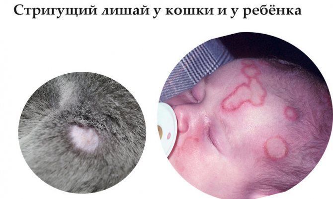 Микроспория