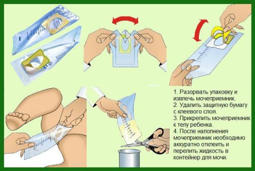 Мочеприемник для ребенка