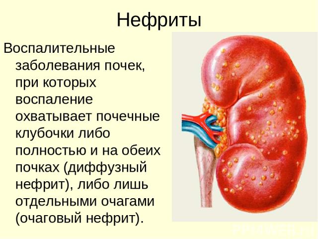 нефрит