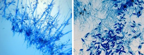 патогенные грибки Microsporum