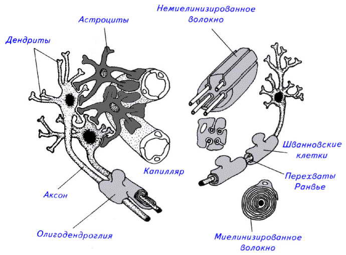 пилоидная астроцитома