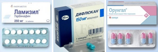 Препараты, принимаемые внутрь при лечении грибка кожи рук и ног