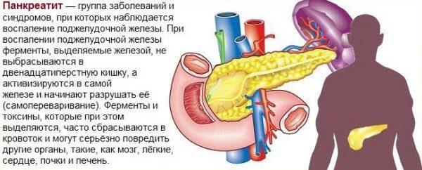 Признаки и симптомы хронического панкреатита