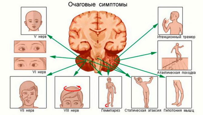 признаки опухоли в зависимости от расположения