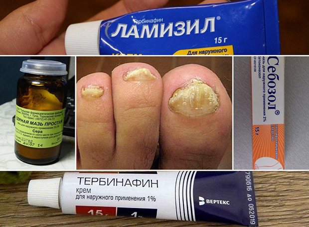 противогрибковые средства