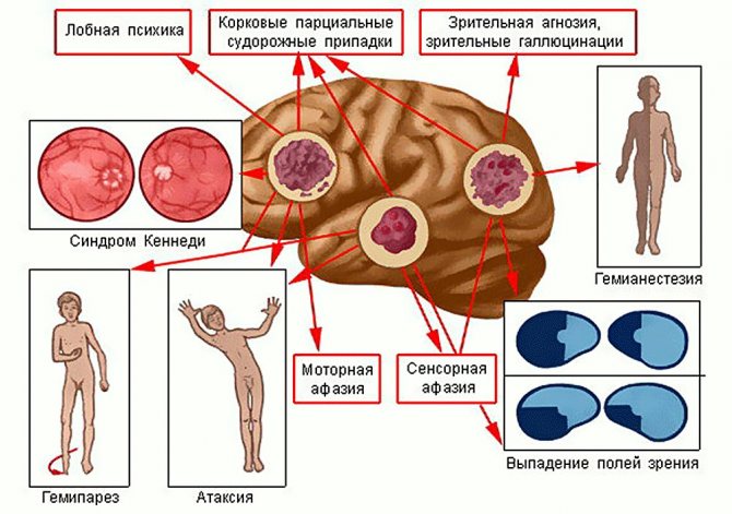 Проявления