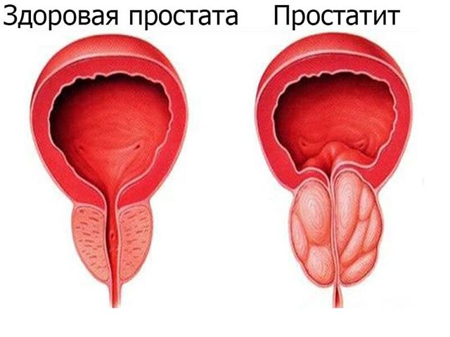 Схематический рисунок