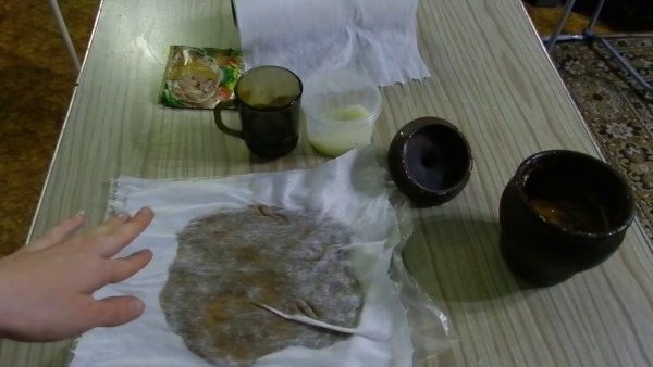 Тоннельный синдром запястного канала. Симптомы и лечение. Гимнастика, народные средства, операция