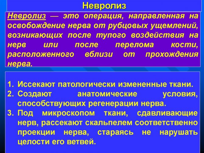 Туннельный синдром лечение