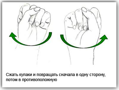 Туннельный синдром запястья: лечение народными средствами и лекарственными препаратами. Симптомы. Отзывы