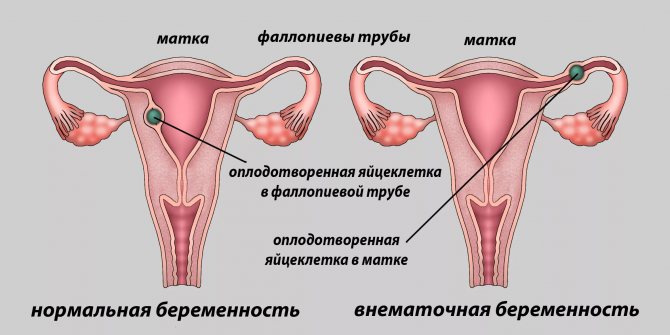 тянет низ живота и частое мочеиспускание