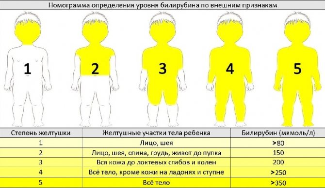 Виды желтухи у новорожденных