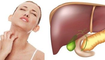 зуд и сыпь при болезнях печени